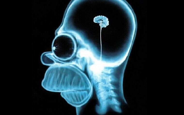 черепа, Гомер Симпсон, мозг, Симпсоны, X-Ray - обои на рабочий стол