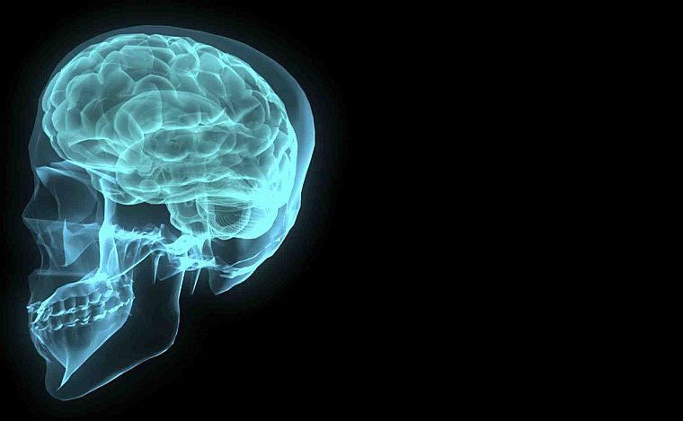 черепа, мозг, X-Ray - обои на рабочий стол