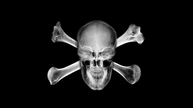 черепа, X-Ray, череп и скрещенные кости - обои на рабочий стол