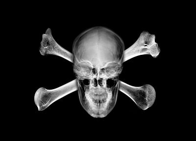 черепа, X-Ray, череп и скрещенные кости - оригинальные обои рабочего стола